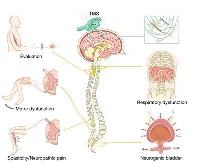 Research progress on the application of transcranial magnetic stimulation in spinal cord injury rehabilitation: a narrative review